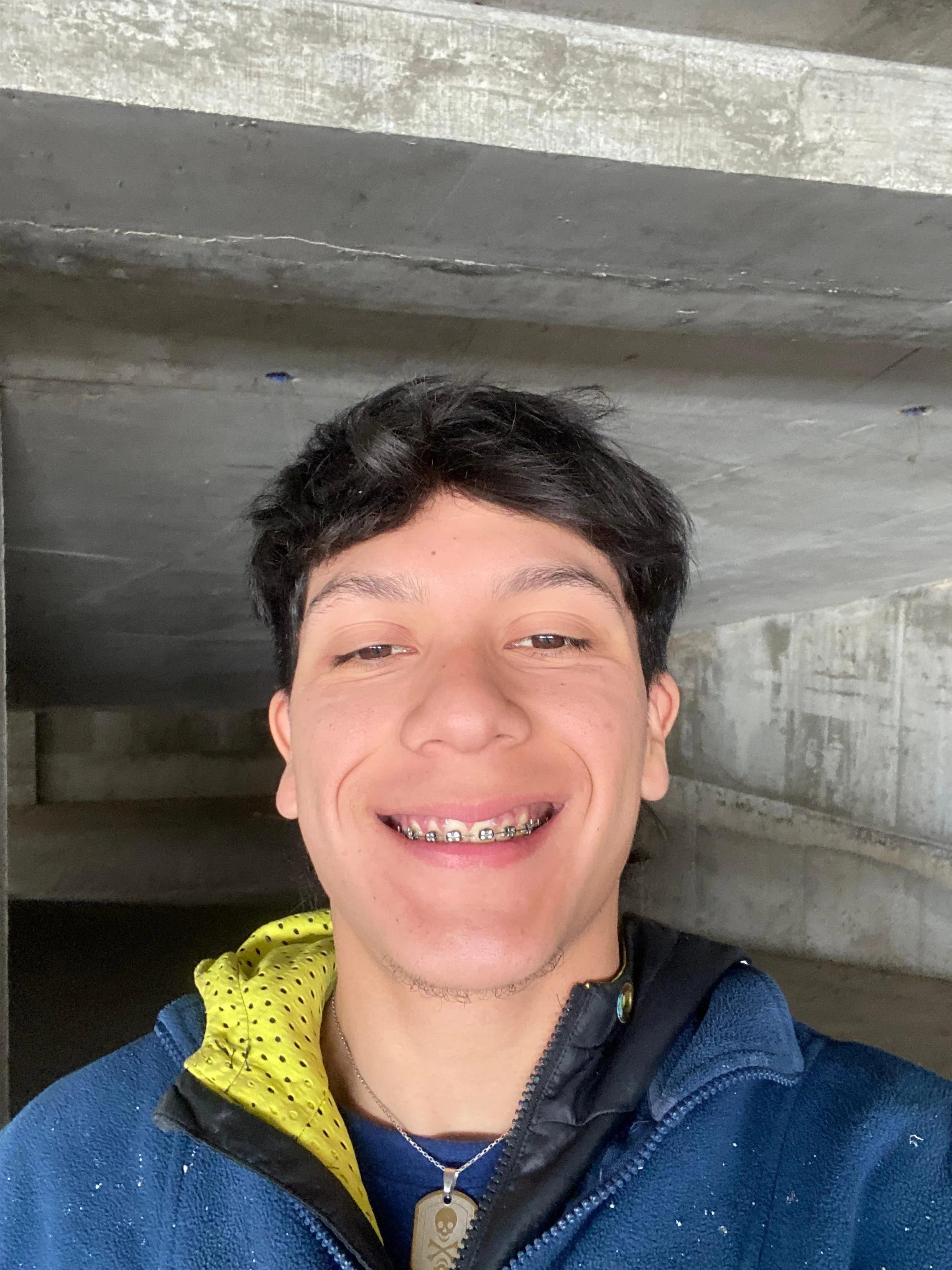 Hugo vera